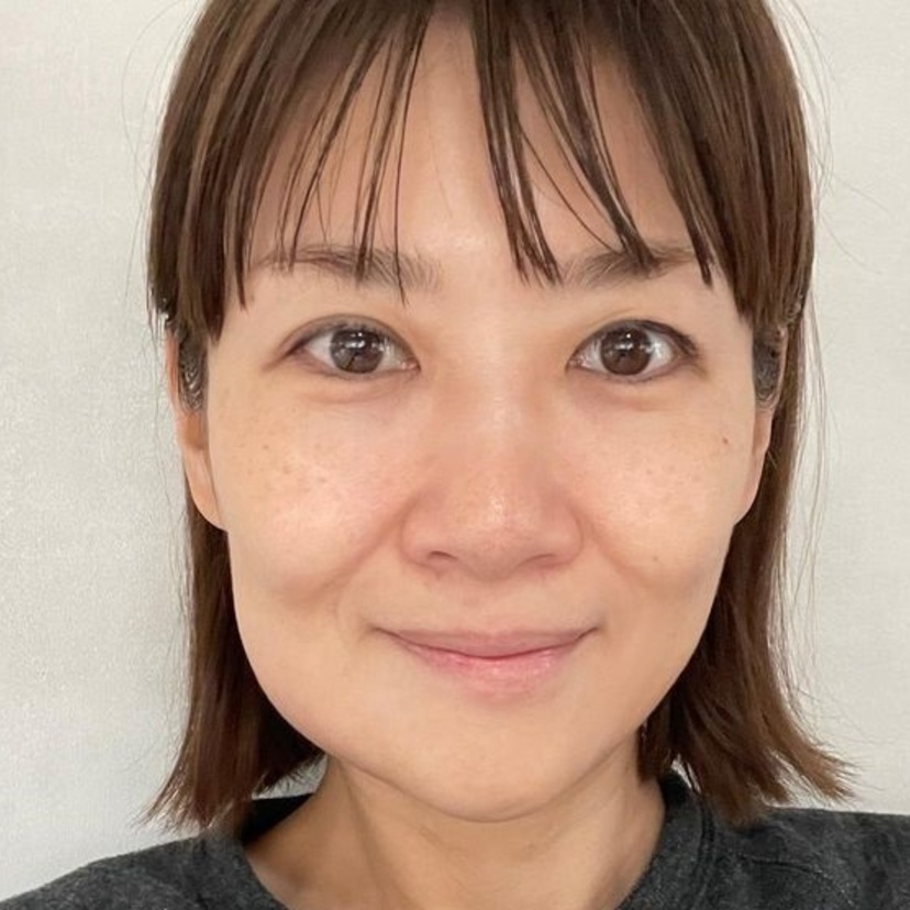「ウリナリ」で一躍人気者に！藤崎奈々子（45）がインプラント手術で顔がどんどん腫れて変形していると話題に！！